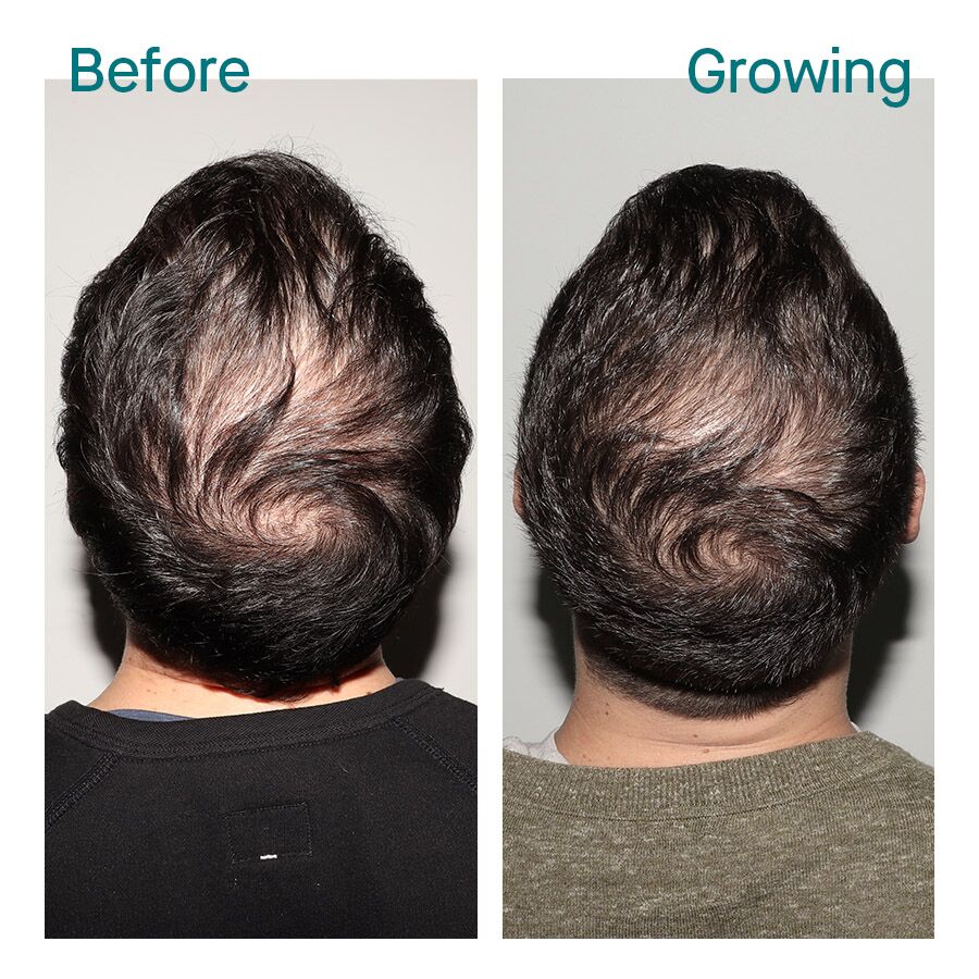 NUTRAFOL FOR MEN