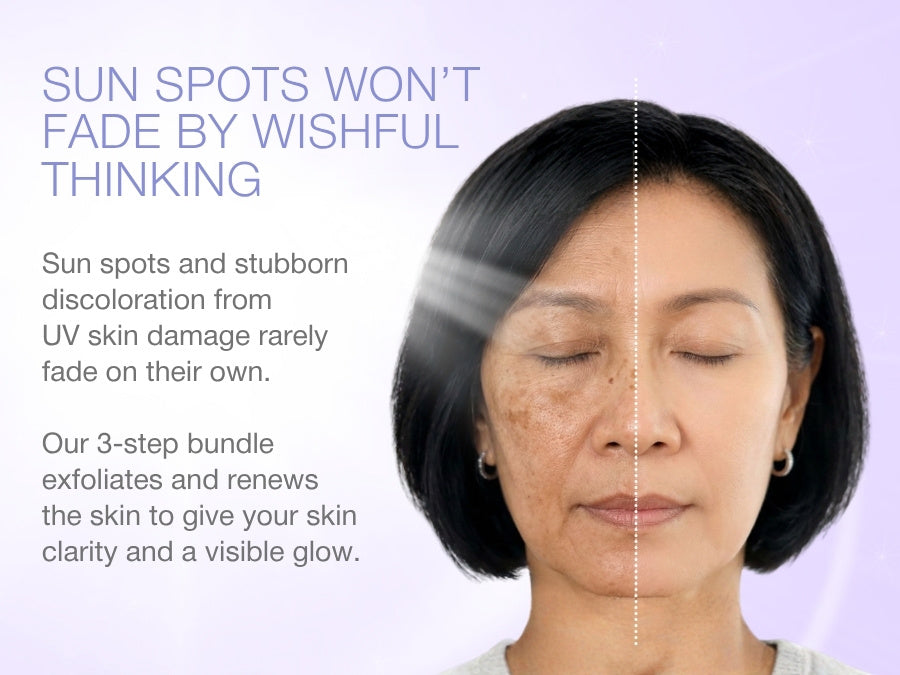 SUN SPOTS BUNDLE-1